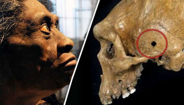 Неудобните артефакти: древни черепи с дупки от куршуми