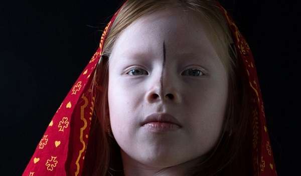 Децата на Луната: тайната на албиносите куни остава нерешена